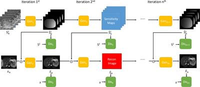 Multi-channel GAN–based calibration-free diffusion-weighted liver imaging with simultaneous coil sensitivity estimation and reconstruction